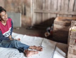 Tujuh Bulan Tinggal di Lorong Martapura Plaza, Zulkarnain Tak Bisa Berjalan