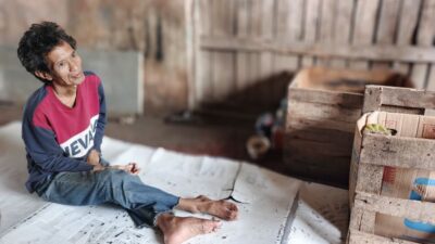 Tujuh Bulan Tinggal di Lorong Martapura Plaza, Zulkarnain Tak Bisa Berjalan